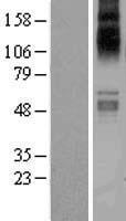 SLC1A7 Human Over-expression Lysate