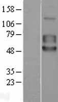 5T4 (TPBG) Human Over-expression Lysate