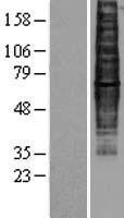 CCR9 Human Over-expression Lysate