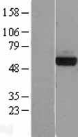 PHGDH Human Over-expression Lysate