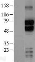 TBR1 Human Over-expression Lysate