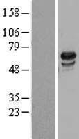 USP39 Human Over-expression Lysate