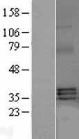 BAFF (TNFSF13B) Human Over-expression Lysate