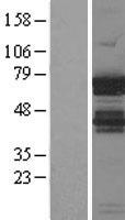 IGF2BP1 Human Over-expression Lysate