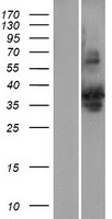 SLBP Human Over-expression Lysate
