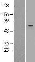TRIM27 Human Over-expression Lysate