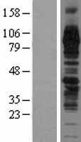 TGN46 (TGOLN2) Human Over-expression Lysate