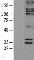 MAP126 (SPAG5) Human Over-expression Lysate