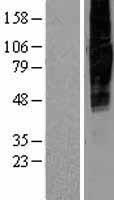 SLC34A2 Human Over-expression Lysate