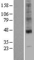 SLC35A1 Human Over-expression Lysate