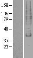TM9SF1 Human Over-expression Lysate