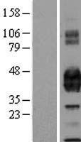 PROCR Human Over-expression Lysate