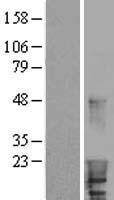 HBXIP (LAMTOR5) Human Over-expression Lysate