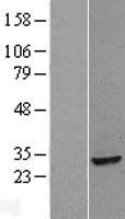 PHAPI2 / APRIL (ANP32B) Human Over-expression Lysate