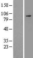 Semaphorin 3c (SEMA3C) Human Over-expression Lysate