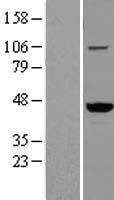 VAT1 Human Over-expression Lysate