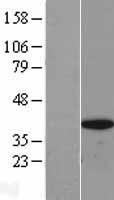 BRAF35 (HMG20B) Human Over-expression Lysate