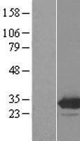 EMG1 Human Over-expression Lysate
