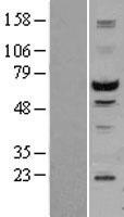 STK3 Human Over-expression Lysate