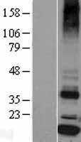 Signal sequence receptor delta (SSR4) Human Over-expression Lysate