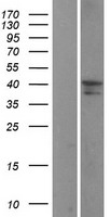 ST3GAL3 Human Over-expression Lysate