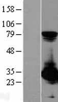 PSME1 Human Over-expression Lysate