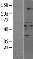 PPP2R5B Human Over-expression Lysate