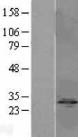 IPP 2 (PPP1R2) Human Over-expression Lysate