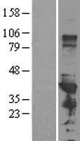 PCBP1 Human Over-expression Lysate