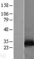 NNMT Human Over-expression Lysate