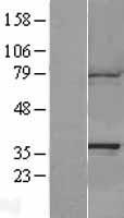 CAPZA1 Human Over-expression Lysate