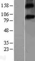 SPON1 Human Over-expression Lysate