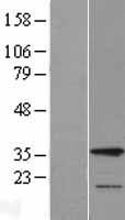 HAX1 Human Over-expression Lysate