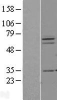PIAS3 Human Over-expression Lysate