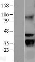RACK1 Human Over-expression Lysate