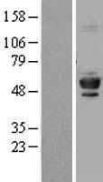 beta IV Tubulin (TUBB4A) Human Over-expression Lysate
