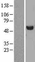 Tubulin (TUBA1B) Human Over-expression Lysate