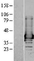 AKR1A1 Human Over-expression Lysate