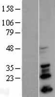 SNAIL (SNAI1) Human Over-expression Lysate