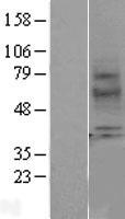 Melatonin Receptor 1A (MTNR1A) Human Over-expression Lysate
