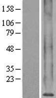 MT1X Human Over-expression Lysate