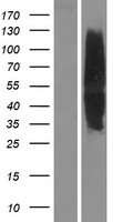 MC4 Receptor (MC4R) Human Over-expression Lysate