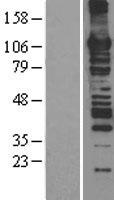 MCM6 Human Over-expression Lysate