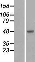 SMAD3 Human Over-expression Lysate