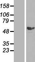 SMAD2 Human Over-expression Lysate