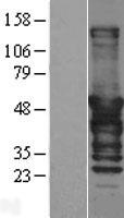 DNAJA2 Human Over-expression Lysate