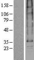SLC35B1 Human Over-expression Lysate