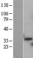 PSMD14 Human Over-expression Lysate