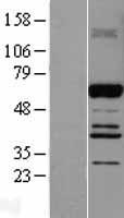 ABI2 Human Over-expression Lysate
