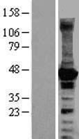 p21 ARC (ARPC3) Human Over-expression Lysate